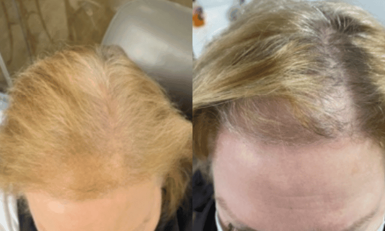  la jolla medical spa patient before and afters